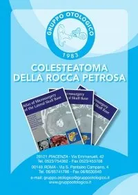 Colesteatoma della rocca petrosa Gruppo Otologico