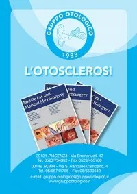 Otosclerosi