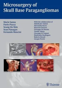 cover microsurgery of skull base paragangliomas
